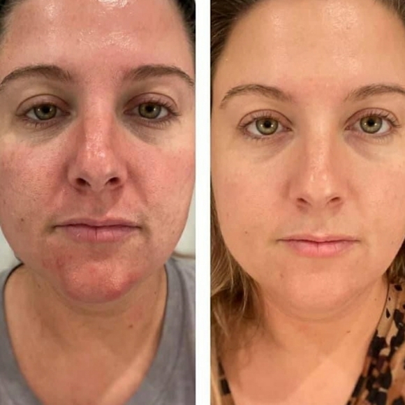 Clinical retinol - Picture 4 of 4